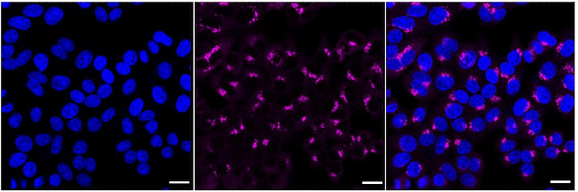 VDP Antibody in Immunocytochemistry (ICC/IF)