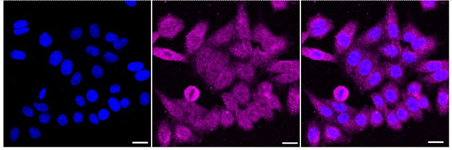 VEGFD Antibody in Immunocytochemistry (ICC/IF)