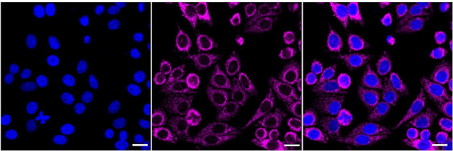 Versican Antibody in Immunocytochemistry (ICC/IF)