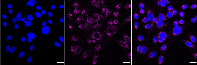 VPS26A Antibody in Immunocytochemistry (ICC/IF)