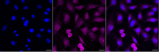 VPS28 Antibody in Immunocytochemistry (ICC/IF)