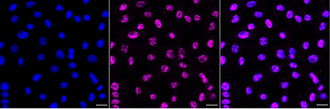 ZEB1 Antibody in Immunocytochemistry (ICC/IF)