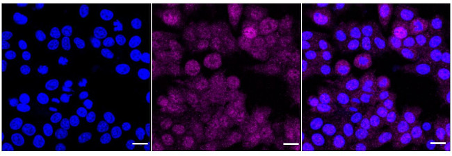ZPR1 Antibody in Immunocytochemistry (ICC/IF)