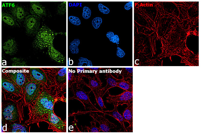 ATF6 Antibody in Immunocytochemistry (ICC/IF)