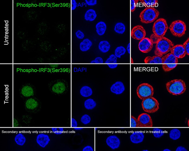 Phospho-IRF3 (Ser396) Antibody in Immunocytochemistry (ICC/IF)