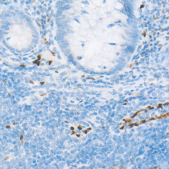 ERG Antibody in Immunohistochemistry (Paraffin) (IHC (P))