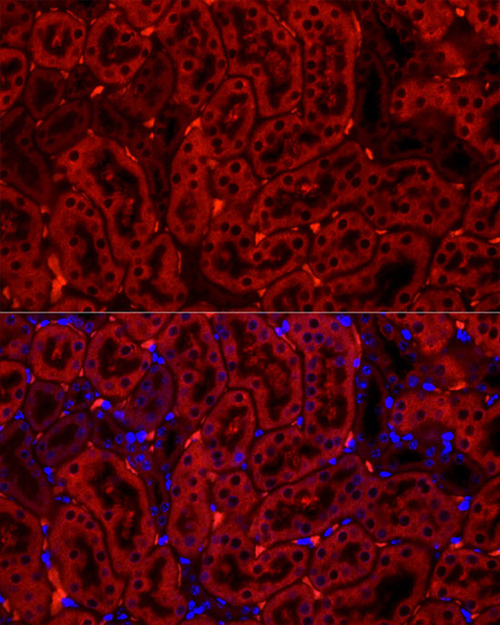 CYP2E1 Antibody in Immunohistochemistry (Paraffin) (IHC (P))