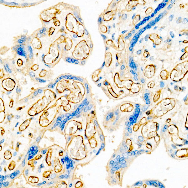 VE-cadherin Antibody in Immunohistochemistry (Paraffin) (IHC (P))