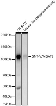 MGAT5 Antibody in Western Blot (WB)