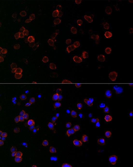 ICAM-1 Antibody in Immunocytochemistry (ICC/IF)