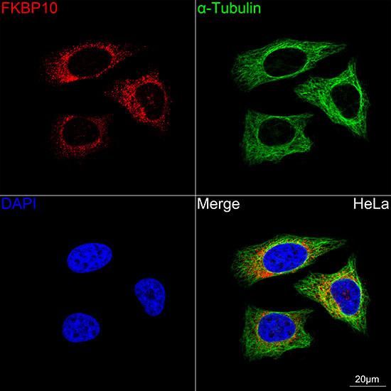 FKBP10 Antibody in Immunocytochemistry (ICC/IF)