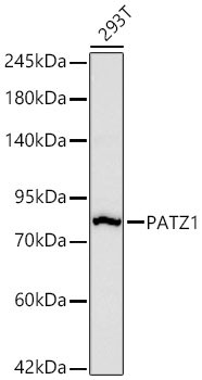 PATZ1 Antibody in Western Blot (WB)