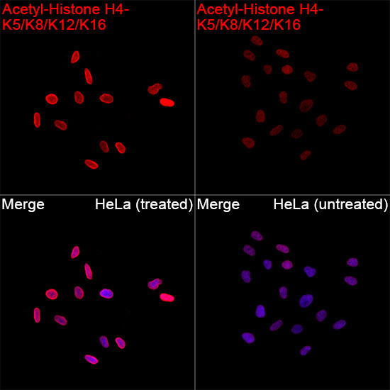 H4ac pan-acetyl (K5,K8,K12,K16) Antibody in Immunocytochemistry (ICC/IF)