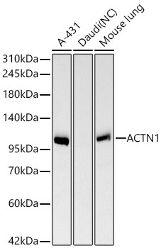 alpha Actinin 1 Antibody in Western Blot (WB)