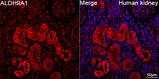 ALDH9A1 Antibody in Immunohistochemistry (Paraffin) (IHC (P))