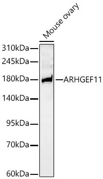 ARHGEF11 Antibody in Western Blot (WB)