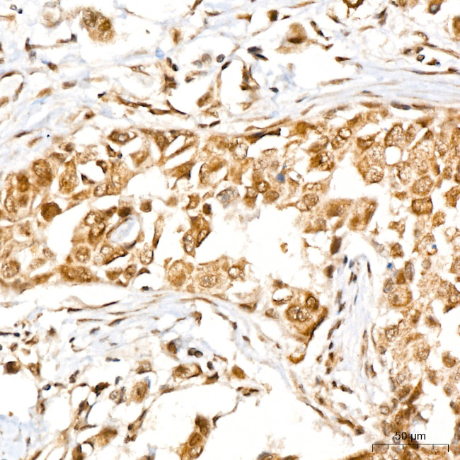 RFWD2 Antibody in Immunohistochemistry (Paraffin) (IHC (P))