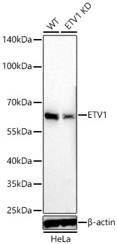 ETV1 Antibody in Western Blot (WB)