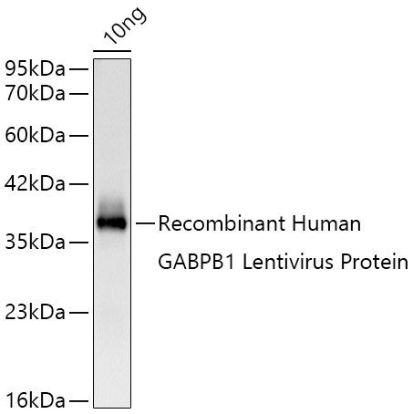 GABPB1 Antibody in Western Blot (WB)
