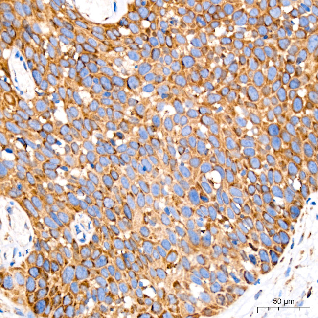 GRP94 Antibody in Immunohistochemistry (Paraffin) (IHC (P))