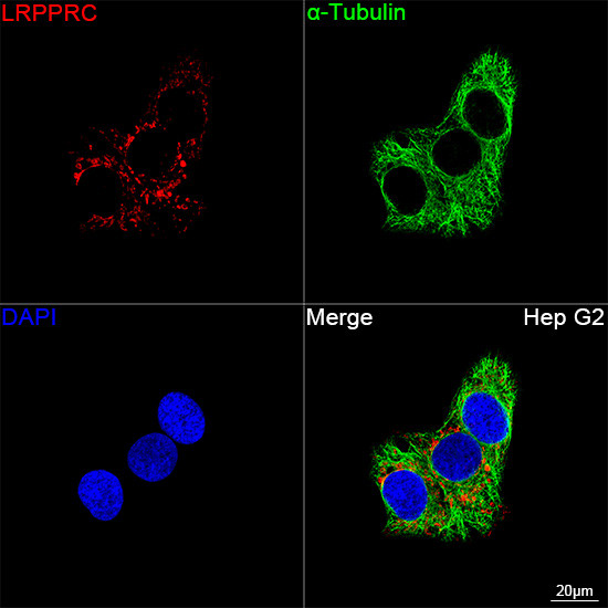 LRP130 Antibody in Immunocytochemistry (ICC/IF)
