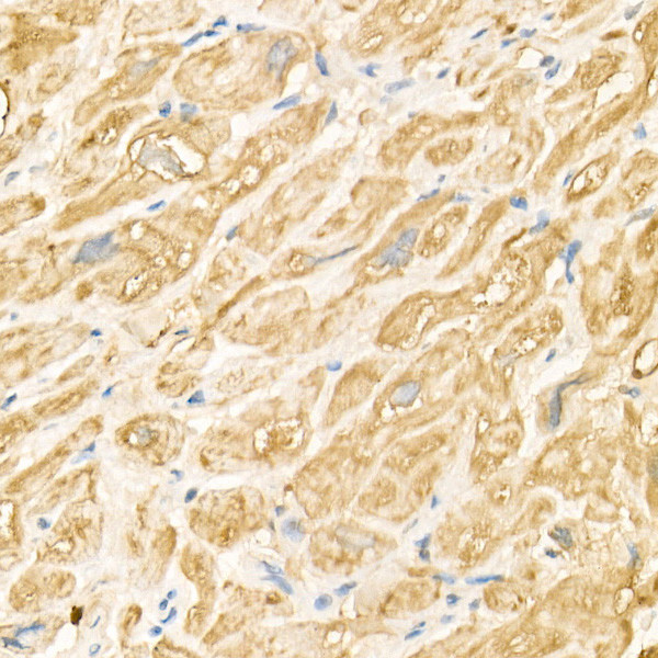 MARCH5 Antibody in Immunohistochemistry (Paraffin) (IHC (P))