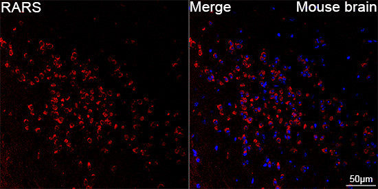 RARS Antibody in Immunohistochemistry (Paraffin) (IHC (P))