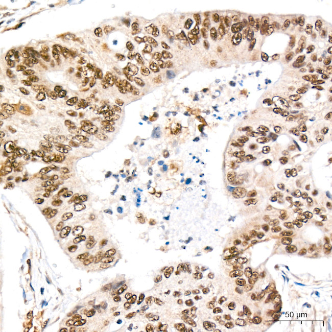 REPIN1 Antibody in Immunohistochemistry (Paraffin) (IHC (P))
