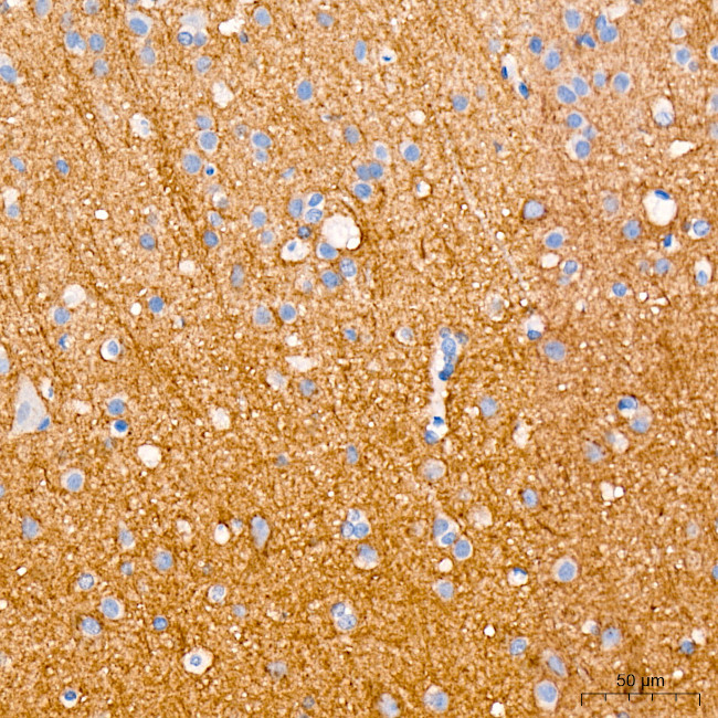 SCN3B Antibody in Immunohistochemistry (Paraffin) (IHC (P))