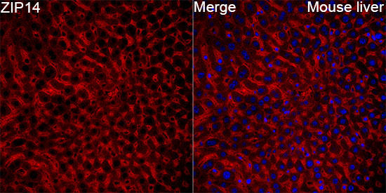 ZIP14 Antibody in Immunohistochemistry (Paraffin) (IHC (P))