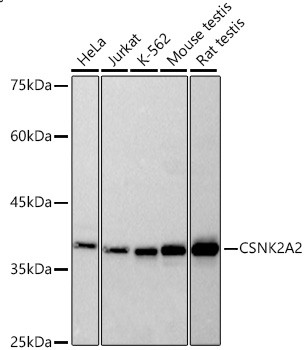 CK2 alpha-2 Antibody in Western Blot (WB)