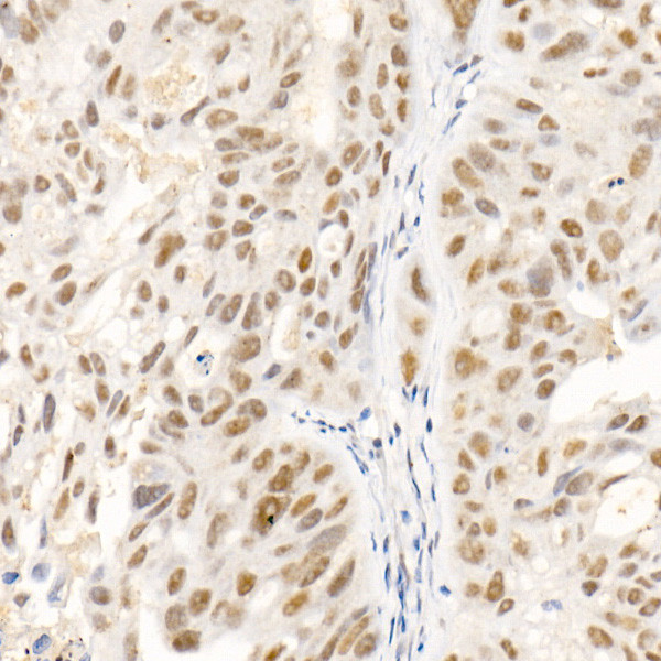 SOCS1 Antibody in Immunohistochemistry (Paraffin) (IHC (P))
