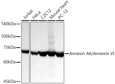 Annexin A6 Antibody in Western Blot (WB)