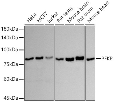 PFKP Antibody in Western Blot (WB)