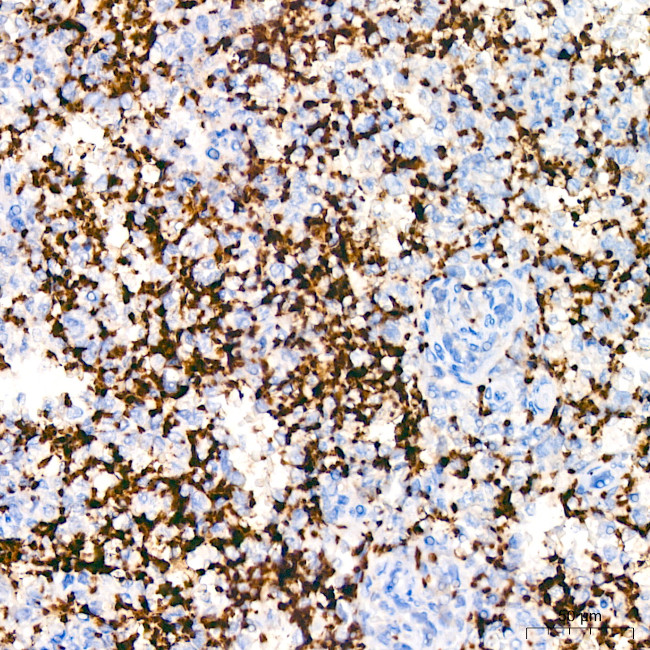 CD42b Antibody in Immunohistochemistry (Paraffin) (IHC (P))