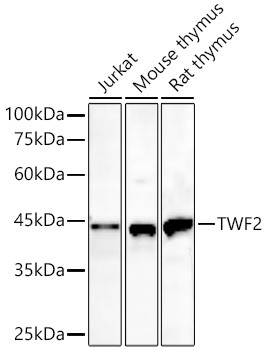 TWF2 Antibody in Western Blot (WB)
