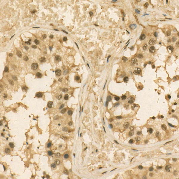 PSMC4 Antibody in Immunohistochemistry (Paraffin) (IHC (P))