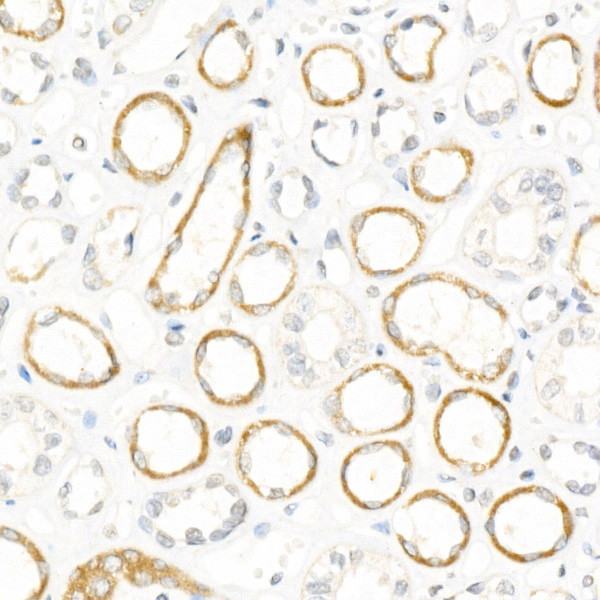 NGLY1 Antibody in Immunohistochemistry (Paraffin) (IHC (P))