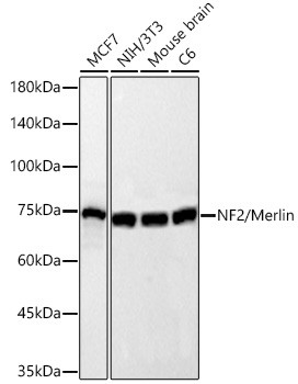 NF2 Antibody in Western Blot (WB)