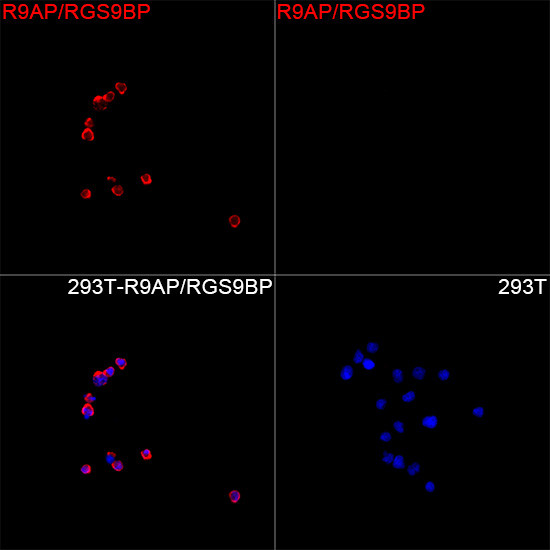 R9BP Antibody in Immunocytochemistry (ICC/IF)