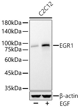 EGR1 Antibody in Western Blot (WB)