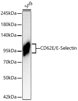 CD62E (E-Selectin) Antibody in Western Blot (WB)