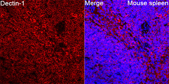 Dectin 1 Antibody in Immunohistochemistry (Paraffin) (IHC (P))