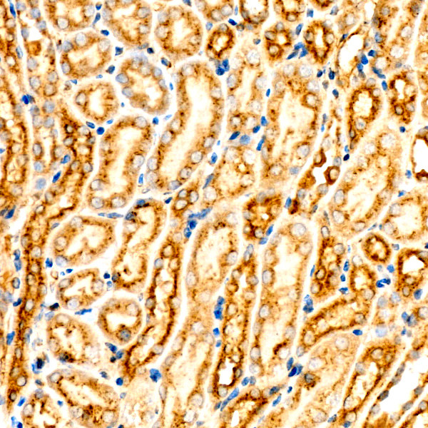 ASM Antibody in Immunohistochemistry (Paraffin) (IHC (P))
