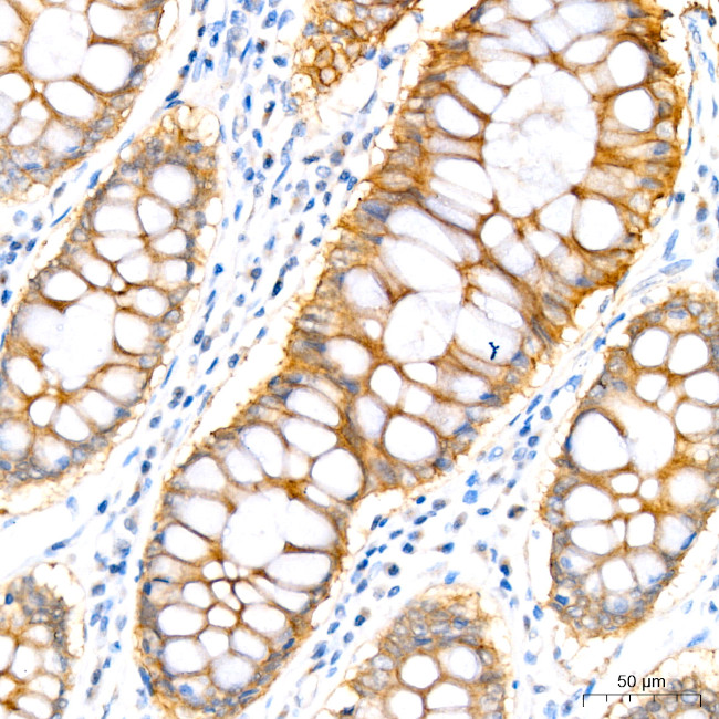 PER1 Antibody in Immunohistochemistry (Paraffin) (IHC (P))