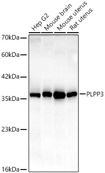 PPAP2B Antibody in Western Blot (WB)