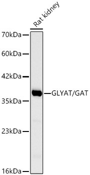 GLYAT Antibody in Western Blot (WB)