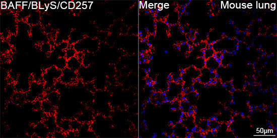 BAFF Antibody in Immunohistochemistry (Paraffin) (IHC (P))