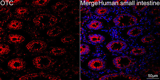 OTC Antibody in Immunohistochemistry (Paraffin) (IHC (P))