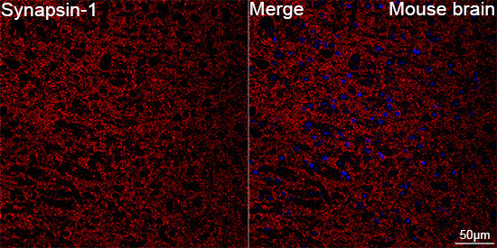 Synapsin 1 Antibody in Immunohistochemistry (Paraffin) (IHC (P))